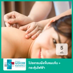 โปรแกรมฝังเข็มแผนจีน + กระตุ้นไฟฟ้า 5 ครั้ง