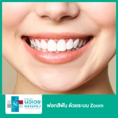 ฟอกสีฟัน ด้วยระบบ Zoom