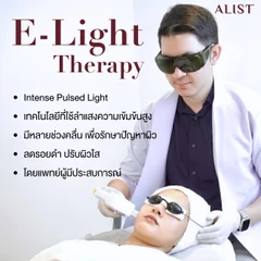 โปรแกรมลดรอยสิวหน้า (E-Light Program) 6 ขั้นตอน