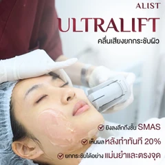 โปรแกรม Ultra Lift 100 ช็อต (หน้า)