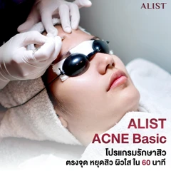 โปรแกรมรักษาสิวหน้า (ALIST Acne Basic) 6 ขั้นตอน