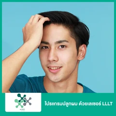 โปรแกรมปลูกผม ด้วยเลเซอร์ LLLT