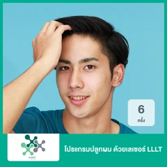 โปรแกรมปลูกผม ด้วยเลเซอร์ LLLT 6 ครั้ง