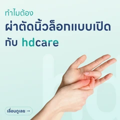 ผ่าตัดนิ้วล็อค