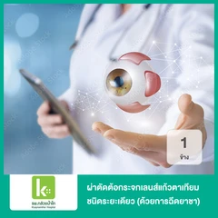 ผ่าตัดต้อกระจกเลนส์แก้วตาเทียม ชนิดระยะเดียว 1 ข้าง ด้วยการฉีดยาชาเฉพาะที่ โดยวิสัญญีแพทย์ (Monofocal IOL)