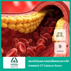 ตรวจไขมันและหลอดเลือดแบบเจาะลึก 9 รายการ รวมตรวจคราบหินปูนในหลอดเลือดหัวใจ (CT Calcium Score) (35 ปีขึ้นไป)