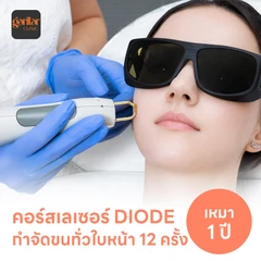 คอร์สเลเซอร์กำจัดขนทั่วหน้า 12 ครั้ง ด้วย Diode Laser