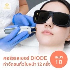 คอร์สเลเซอร์กำจัดขนทั่วหน้า 12 ครั้ง ด้วย Diode Laser