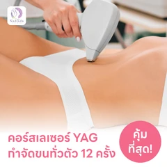 คอร์สเลเซอร์กำจัดขนเหมาทั่วตัว 12 ครั้ง ด้วย YAG Laser (ผู้หญิงเท่านั้น)