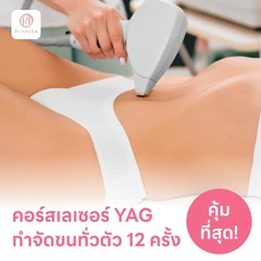 คอร์สเลเซอร์กำจัดขนเหมาทั่วตัว 12 ครั้ง ด้วย YAG Laser