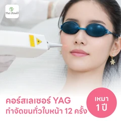 คอร์สเลเซอร์กำจัดขนทั่วหน้า 12 ครั้ง ด้วย YAG Laser