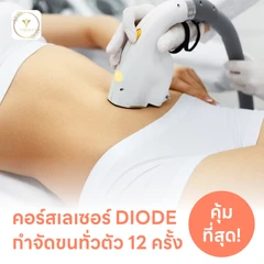 คอร์สเลเซอร์กำจัดขนทั่วร่างกาย 12 ครั้ง ด้วย Diode Laser