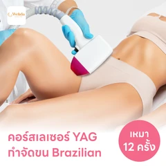 คอร์สเลเซอร์กำจัดขนน้องสาวแบบ Brazilian (vVI) 12 ครั้ง ด้วย YAG Laser