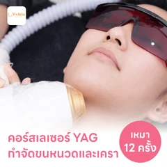 คอร์สเลเซอร์กำจัดขนหนวดและเครา 12 ครั้ง ด้วย YAG Laser