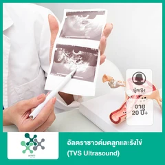 อัลตราซาวด์มดลูกและรังไข่ (TVS Ultrasound) (ผู้หญิง 20 ปีขึ้นไป)