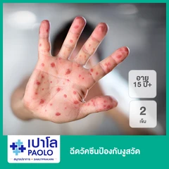 ฉีดวัคซีนป้องกันงูสวัด 2 เข็ม (15 ปีขึ้นไป)