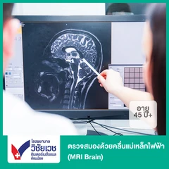 ตรวจสมองด้วยคลื่นแม่เหล็กไฟฟ้า (MRI Brain) (45 ปีขึ้นไป)