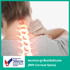 ตรวจกระดูกสันหลังส่วนคอ ด้วยคลื่นแม่เหล็กไฟฟ้า (MRI Cervical Spine) (ทุกช่วงวัย)