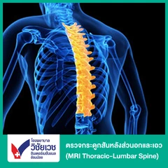 ตรวจกระดูกสันหลังส่วนอกและเอว ด้วยคลื่นแม่เหล็กไฟฟ้า (MRI Thoracic-Lumbar Spine) (ทุกช่วงวัย)