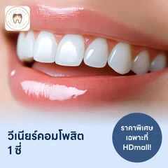 ทำวีเนียร์คอมโพสิต 1 ซี่