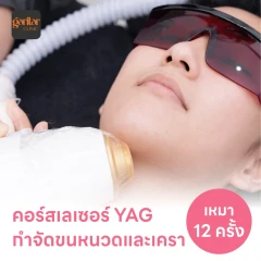คอร์สเลเซอร์กำจัดขนหนวดและเครา 12 ครั้ง ด้วย YAG Laser