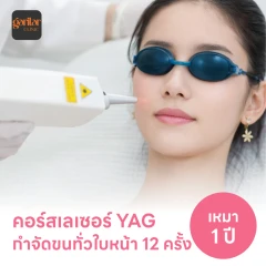 คอร์สเลเซอร์กำจัดขนทั่วหน้า 12 ครั้ง ด้วย YAG Laser