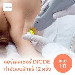 คอร์สเลเซอร์กำจัดขนรักแร้ 12 ครั้ง ด้วย Diode Laser