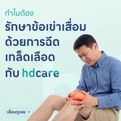 รักษาข้อเข่าเสื่อมด้วยการฉีดเกล็ดเลือดเข้มข้น