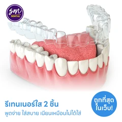 ทำรีเทนเนอร์แบบใส 2 ชิ้น