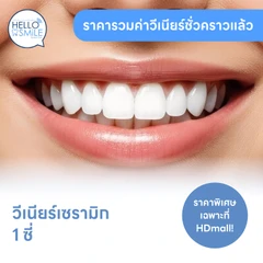 ทำวีเนียร์เซรามิก E-Max 1 ซี่