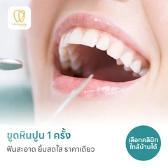 ขูดหินปูน