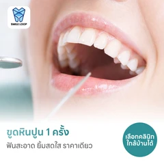 ขูดหินปูน