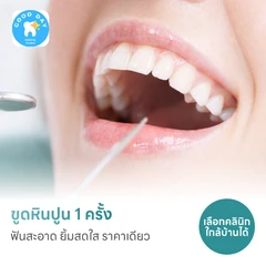ขูดหินปูน