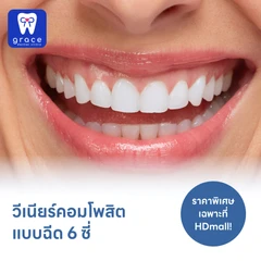 ทำวีเนียร์คอมโพสิตแบบฉีด 6 ซี่