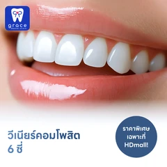 ทำวีเนียร์คอมโพสิต 6 ซี่