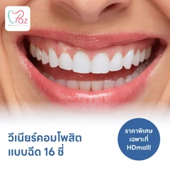 ทำวีเนียร์คอมโพสิตแบบฉีด 16 ซี่