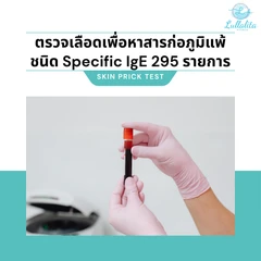 ตรวจสารก่อภูมิแพ้ชนิด Specific IgE แบบ Multiplex 295 รายการ (ทุกช่วงวัย เจาะเลือด)