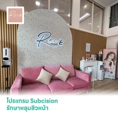 โปรแกรม Subcision รักษาหลุมสิวหน้า