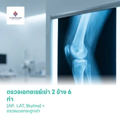 ตรวจคัดกรองข้อเข่าเสื่อม 2 ข้าง 5 ท่า (AP, LAT, Skyline) ด้วยการเอกซเรย์ + ตรวจมวลกระดูกเพื่อคัดกรองภาวะกระดูกพรุน 3 ส่วน ด้วย DEXA Scan