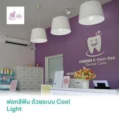 ฟอกสีฟัน ด้วยระบบ Cool Light