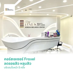 คอร์สเลเซอร์ Fraxel ลดรอยสิว หลุมสิว บริเวณใบหน้า 5 ครั้ง