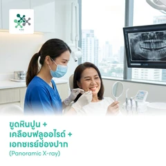 ขูดหินปูน + เคลือบฟลูออไรด์ + เอกซเรย์ช่องปาก (Panoramic X-ray)