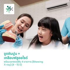 ขูดหินปูน + เคลือบฟลูออไรด์ พร้อมเอกซเรย์ฟัน 4 รายการ (Bitewing X-ray) (4-15 ปี)