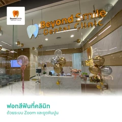ฟอกสีฟันที่คลินิก ด้วยระบบ Zoom น้ำยาจากอเมริกา 2 รอบ 1 ครั้ง และขูดหินปูน 1 ครั้ง