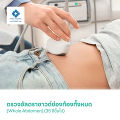 ตรวจอัลตราซาวด์ช่องท้องทั้งหมด (Whole Abdomen) (35 ปีขึ้นไป)