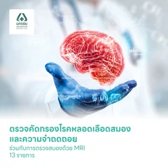 ตรวจคัดกรองโรคหลอดเลือดสมอง และความจำถดถอยจากโรคหลอดเลือดสมอง ร่วมกับการตรวจสมองด้วย MRI 13 รายการ