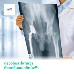 ตรวจข้อสะโพกขวา ด้วยคลื่นแม่เหล็กไฟฟ้า (MRI RT Hip)