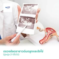 ตรวจอัลตราซาวด์มดลูกและรังไข่ (ผู้หญิง 21 ปีขึ้นไป)