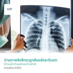 ถ่ายภาพรังสีกระดูกสันหลังระดับอก (ด้านหน้า ด้านหลังและด้านข้าง) สำหรับผู้ที่อายุ 15 ปีขึ้นไป