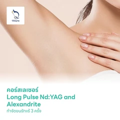 คอร์สเลเซอร์ Long Pulse Nd:YAG and Alexandrite กำจัดขนรักแร้ 3 ครั้ง